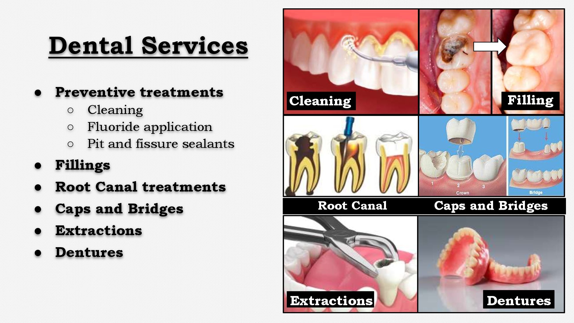 Full List Of Dental Services Types